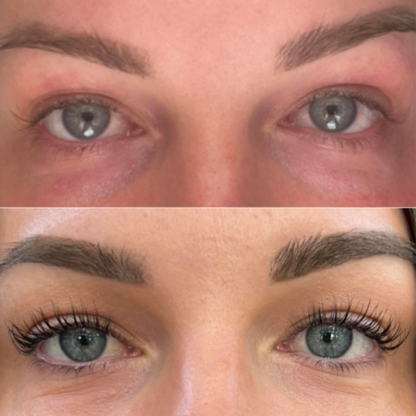 Lashella Eyelash Growth Serum